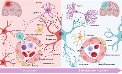 The Specific Role of Reactive Astrocytes in Stroke